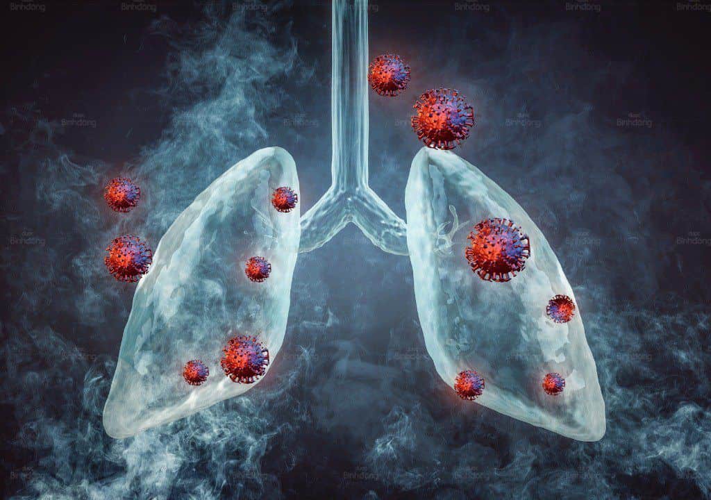 Hình ảnh về bộ phận phổi đang bị virus tấn công